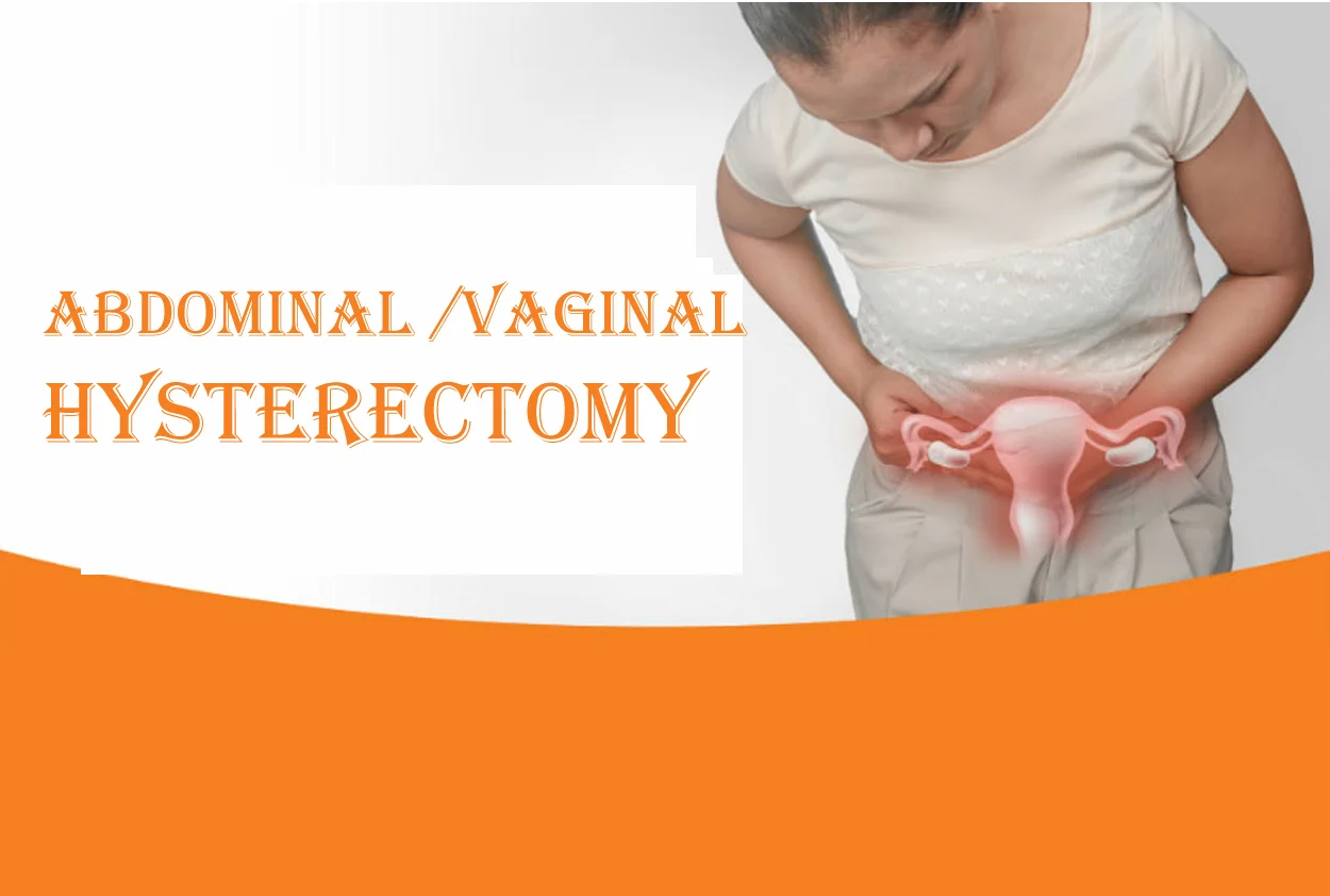 Abdominal / Vaginal Hysterectomy