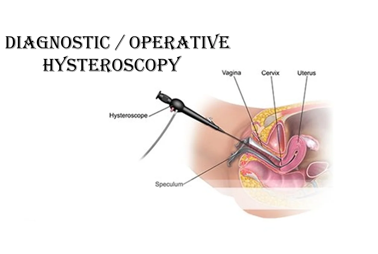 Diagnostic / Operative Hysteroscopy